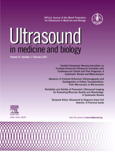 3D Ultrasound and Thyroid Cancer Diagnosis: A Prospective Study